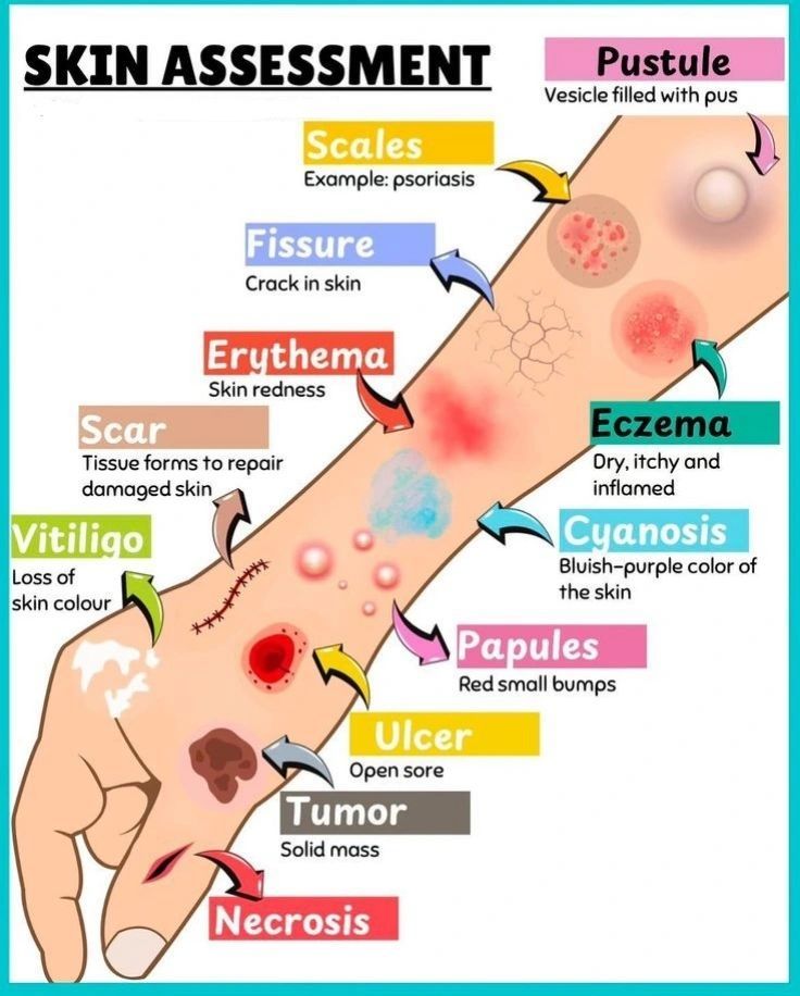 skin assessment